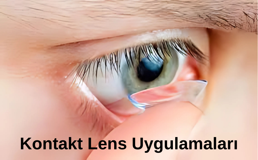 kontakt lens